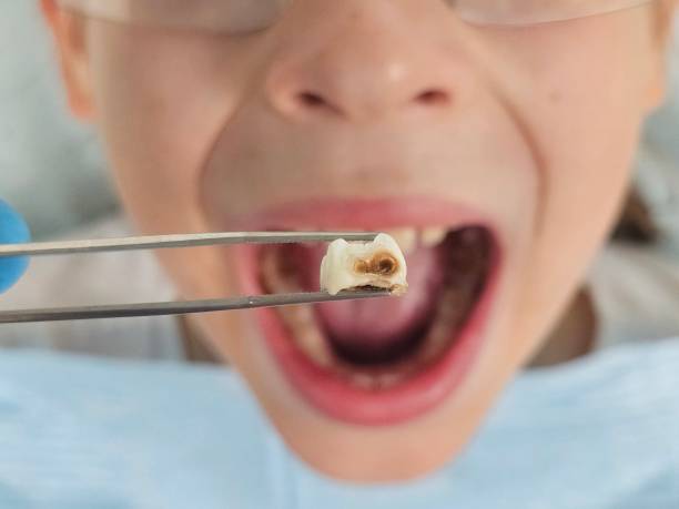 Best Broken Tooth Emergency  in Fredericksburg, TX